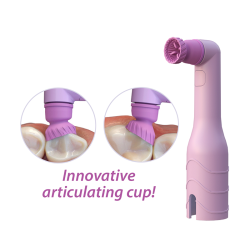 ProFlare® Articulating Disposable Prophy Angle